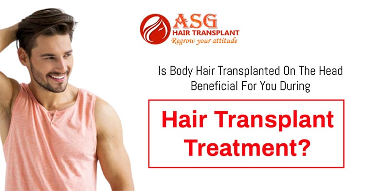 Is body hair transplanted on the head beneficial for you during hair transplant treatment