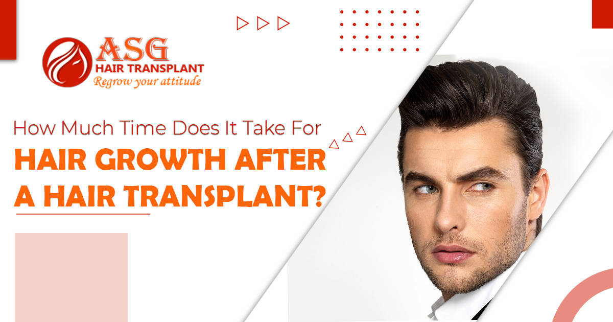 How-much-time-does-it-take-for-hair-growth-after-a-hair-transplant