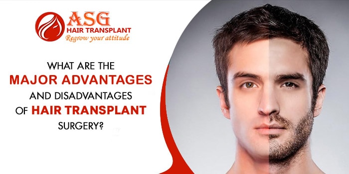 What are the major advantages and disadvantages of hair transplant surgery