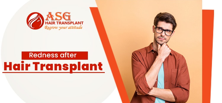 Redness-after-hair-transplant-asg-jpg