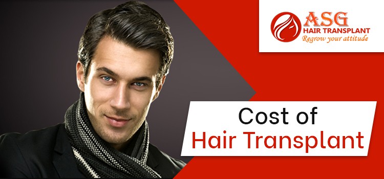 Cost of Hair Transplant