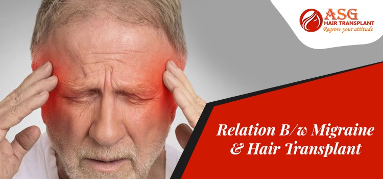 Relationbetween--Migraine-&-Hair-Transplant-asg-hair-transplant