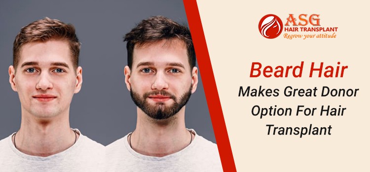 Beard-Hair-Makes-Great-Donor-Option-For-Hair-Transplant-asg-hair-transplant
