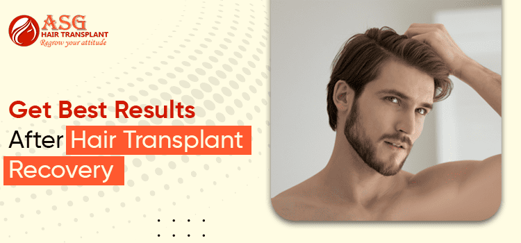 get Best Results After Hair Transplant Recovery