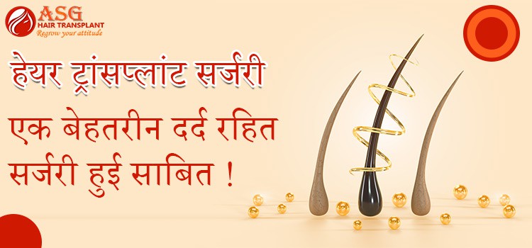 हेयर ट्रांसप्लांट सर्जरी एक बेहतरीन दर्द रहित सर्जरी हुई साबित !