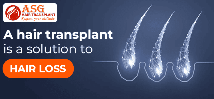 A hair transplant is a solution to hair loss