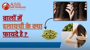Cilantro seeds for hair growth and hair fall remedy in hair transplant recovery process.