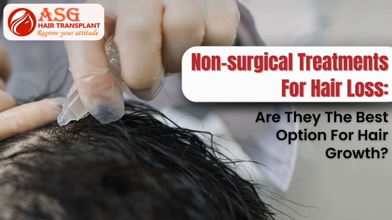 Non-surgical Treatments For Hair Loss: Are They The Best Option For Hair Growth?