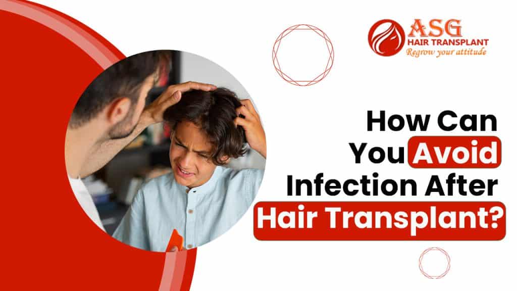 Essential Tips to Prevent Infection After Hair Transplant Surgery