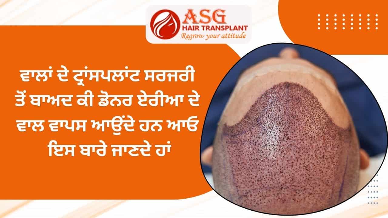 Dense hair follicle grafts for hair transplant procedures.