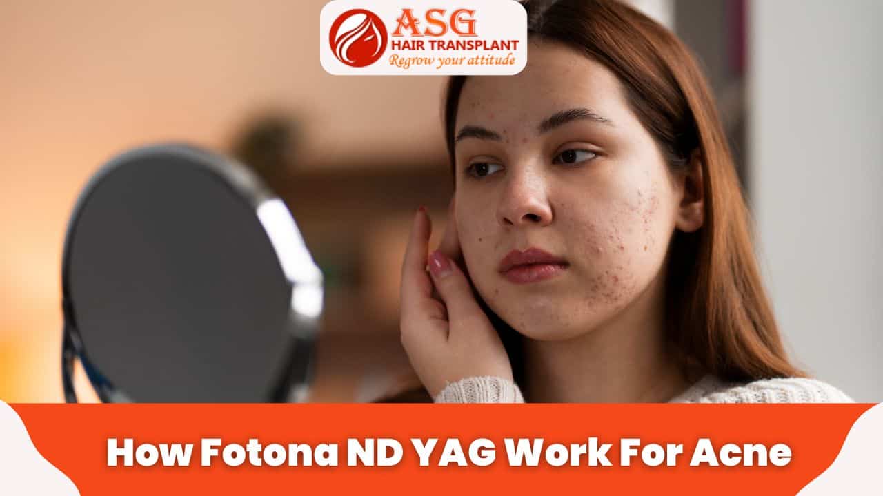 Acne-prone woman examining her skin in mirror, highlighting skin care concerns.