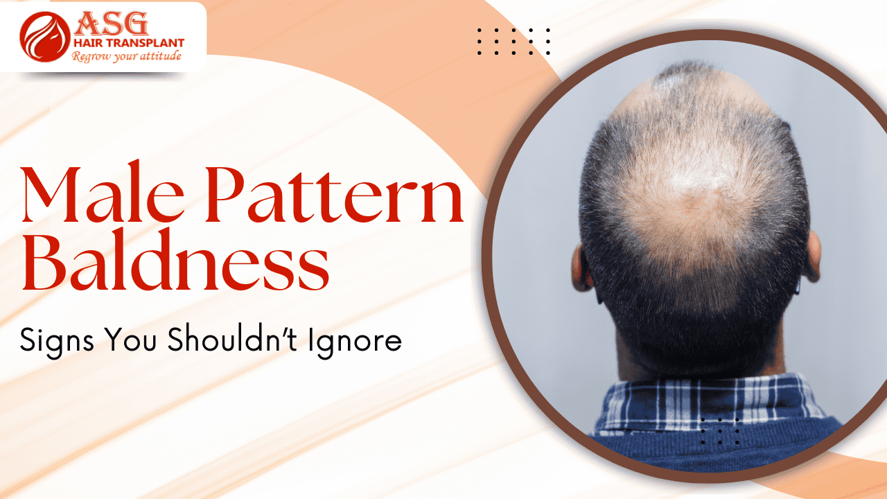 Male Pattern Baldness