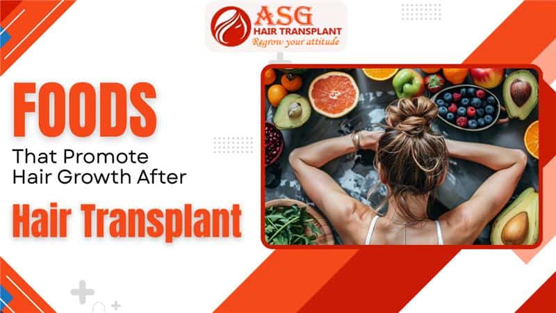 Foods that promote hair growth after hair transplant
