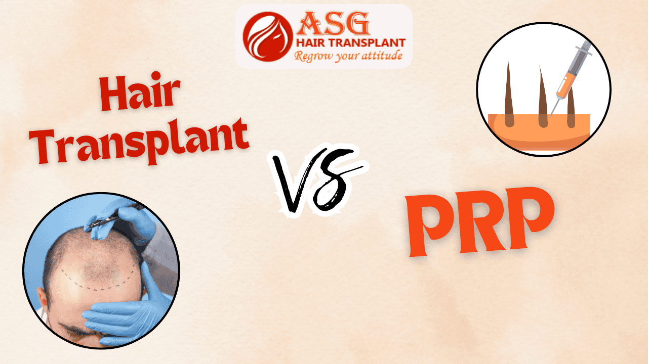 difference between hair transplant and PRP