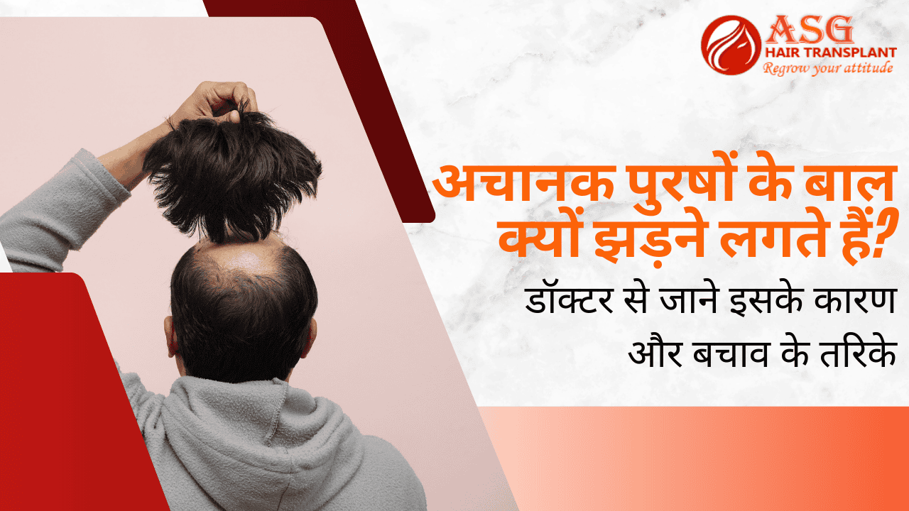 Reasons why mens hair suddenly start falling