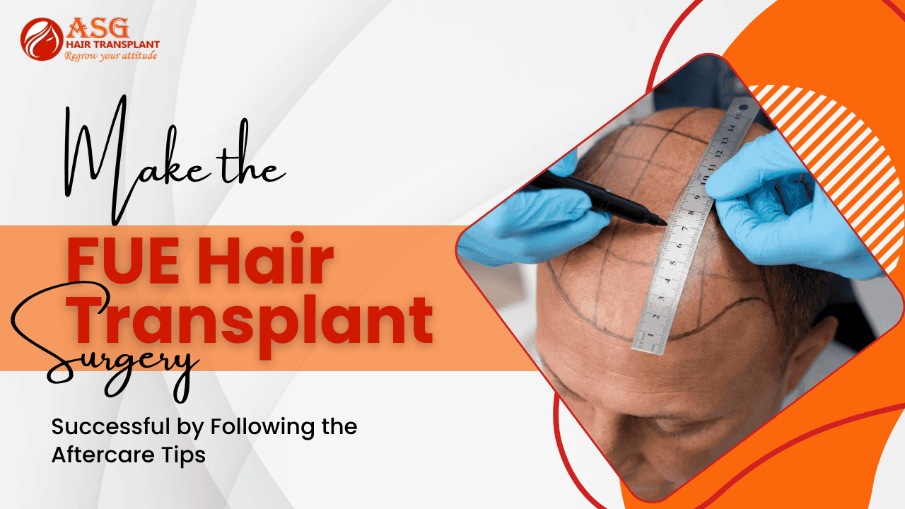 Make the FUE Hair Transplant Surgery Successful by Following the Aftercare Tips