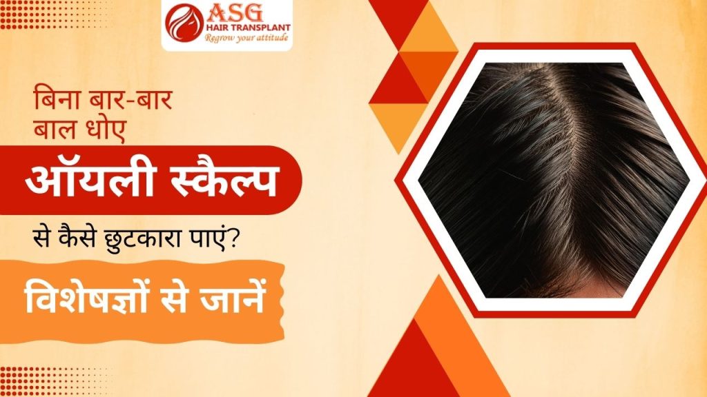 This image describe how to get rid from oily scalp without washing your hair too often.