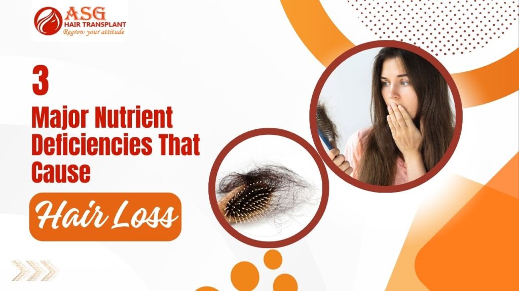 3 Major Nutrient Deficiencies That Cause Hair Loss