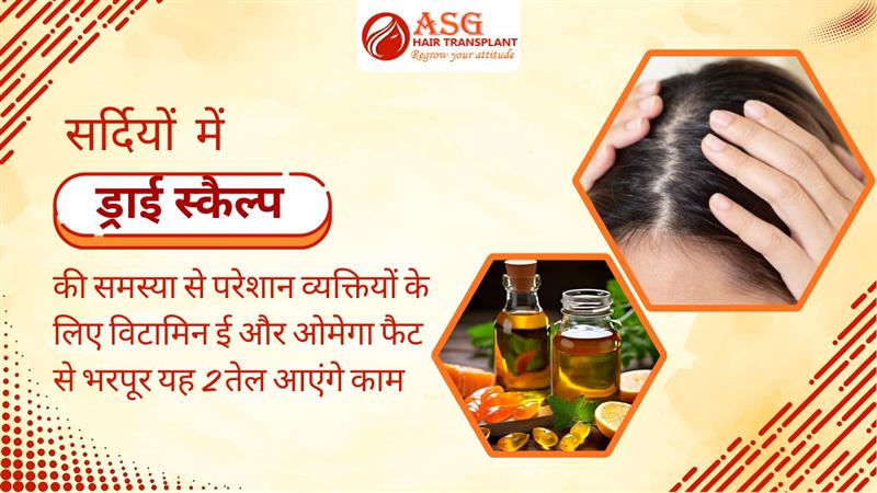 Suffering from dry scalp problems in winter try this oil that rich in vitamin-e and omega fats.