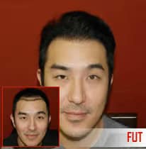 Healthy man with recent hair transplant at ASG Hair Transplant Centre.