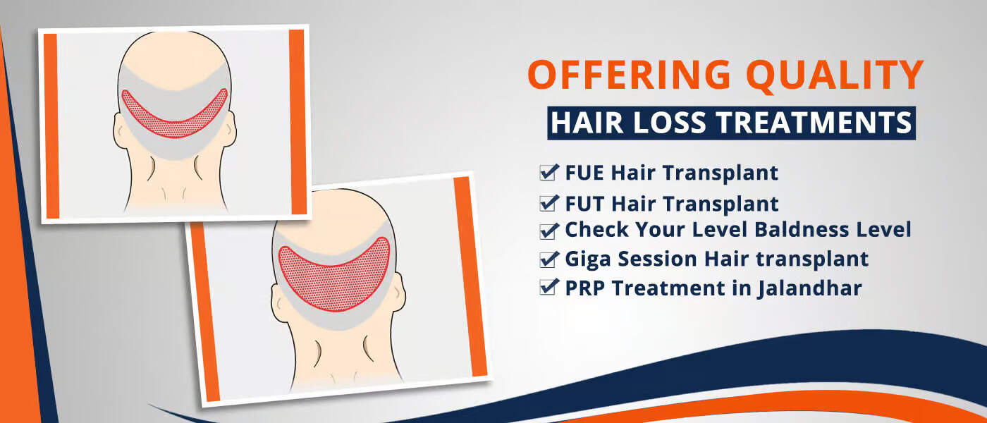 FUE hair transplant illustration, hair loss treatment options, asghairtransplant.com.
