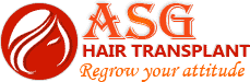 Healthy hair transplant procedure at ASG Hair Transplant Centre in Dubai.