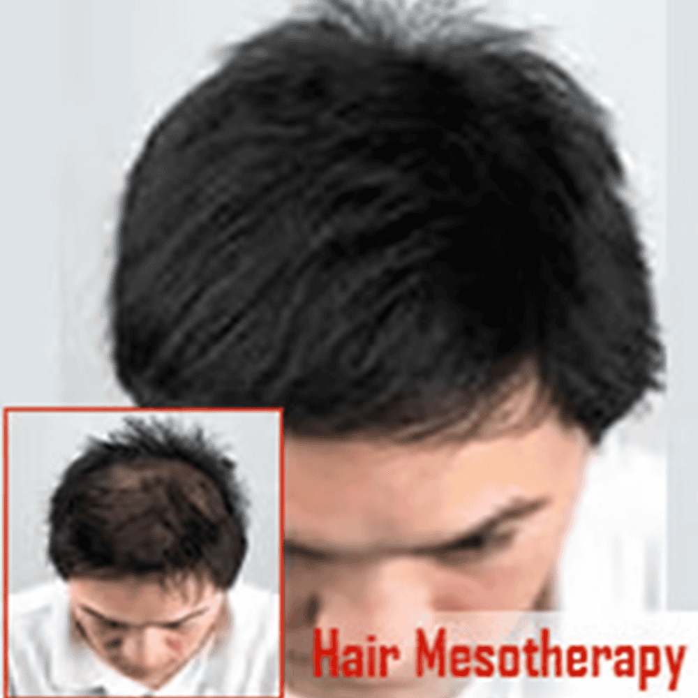 Thick black hair with hair transplant before and after images at ASG Hair Transplant Centre.