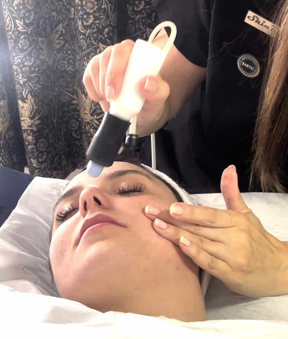 Microdermabrasion