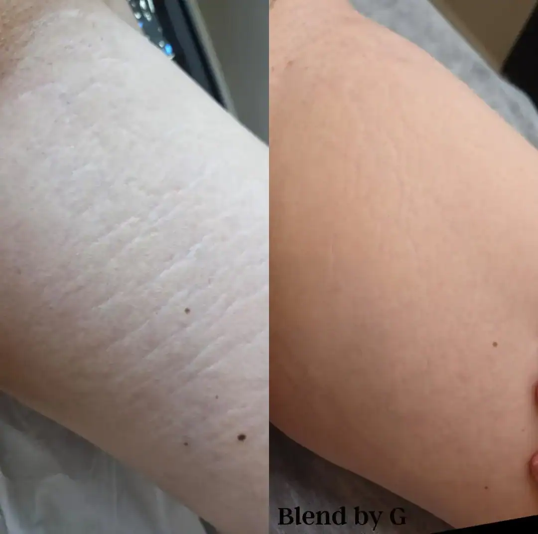 Close-up of skin before and after treatment showing improved texture and appearance.