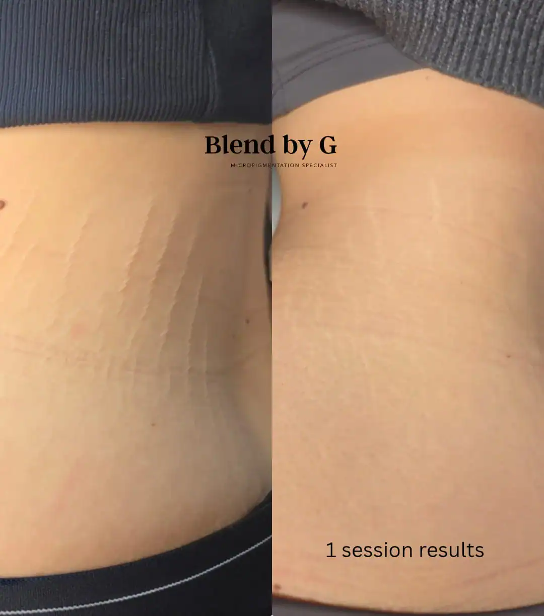 Close-up of smooth, even-toned skin after one session at Blend by G.