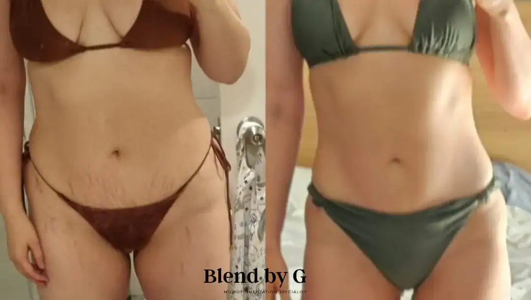 Woman's body transformation showing weight loss and toning in bikini.