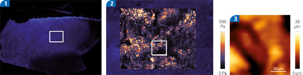 Cervix Tissue: Stiffness Mapping