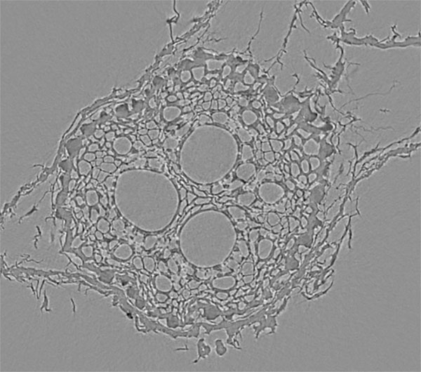 Small Angle Scattering in Micro-CT