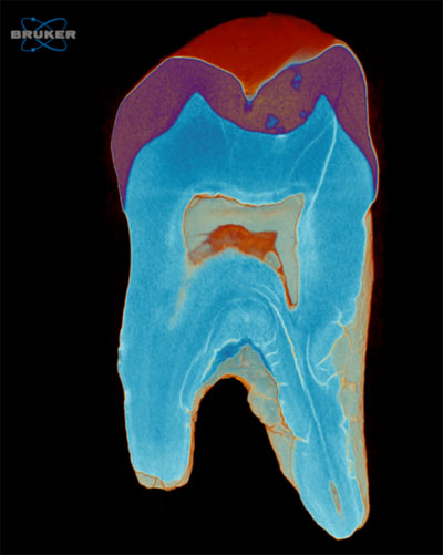 Microtomography Scan of a Tooth