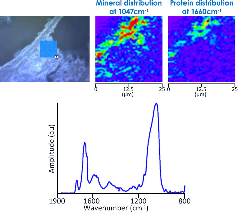 Mineral Distribution on Bone