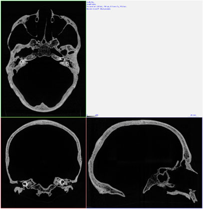 Neanderthal Skull - Micro-CT Scan