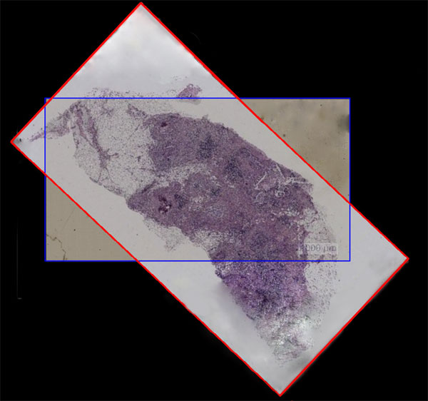 Oesophageal Microtome Slice