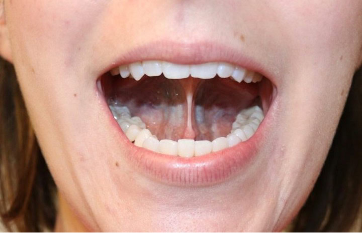 Relaxed mouth open for breathing exercises and mindfulness practice at Breathe First.