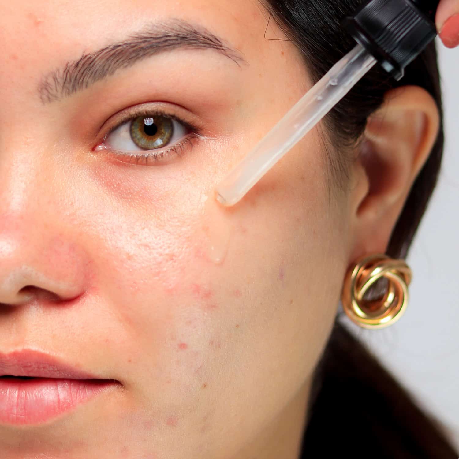 Sérum Facial Antiacne Carla Leone 30ml _ Img 4