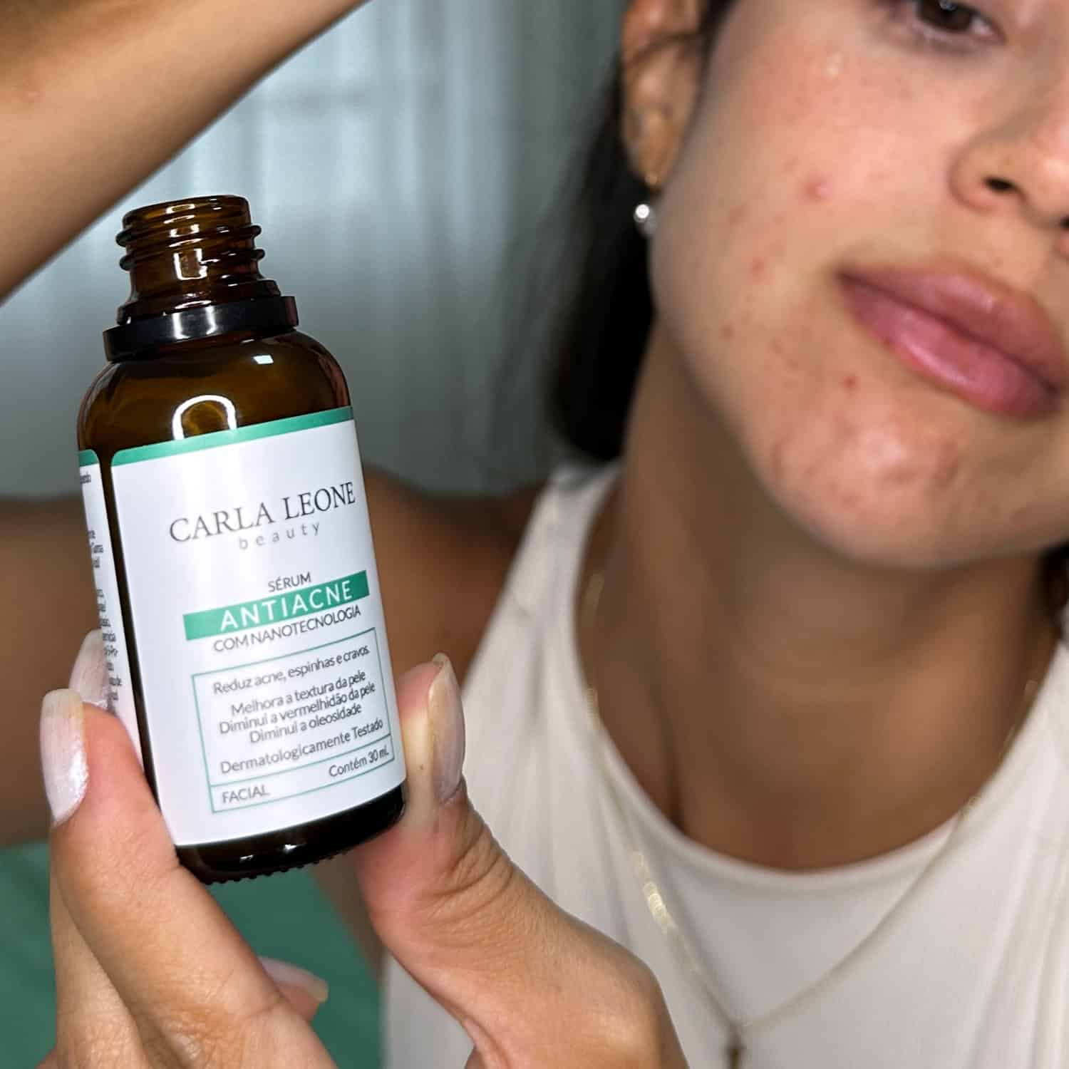 Sérum Facial Antiacne Carla Leone 30ml _ Img 5