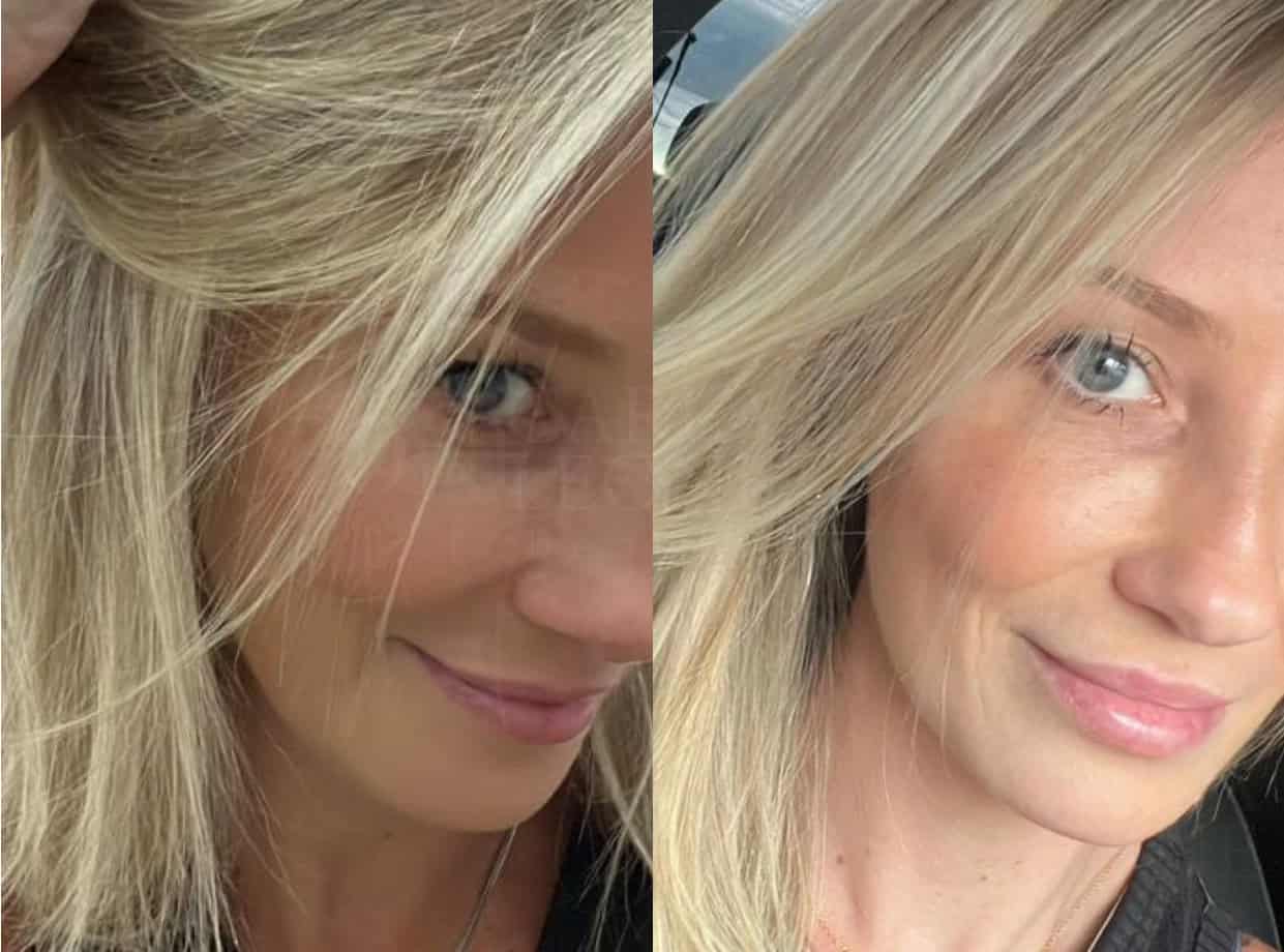 Meu cabelo mudou muitoooo! Tomo e indico pra todo mundo!


Aline Freitas | Cliente Carla Leone Beauty