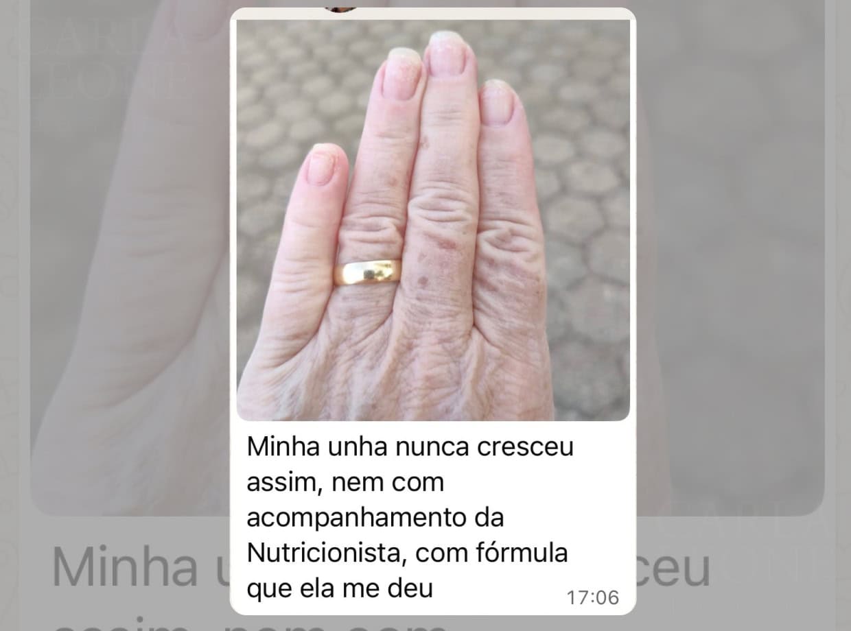 Minha unha nunca cresceu assim, nem com acompanhamento da Nutricionista, com fórmula que ela me deu


Regina Caruso | Cliente Carla Leone Beauty