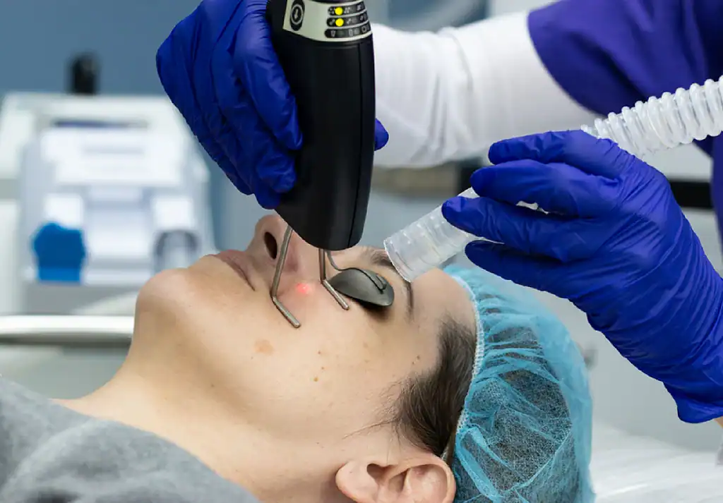 Why High-Quality Laser Consumables Matter