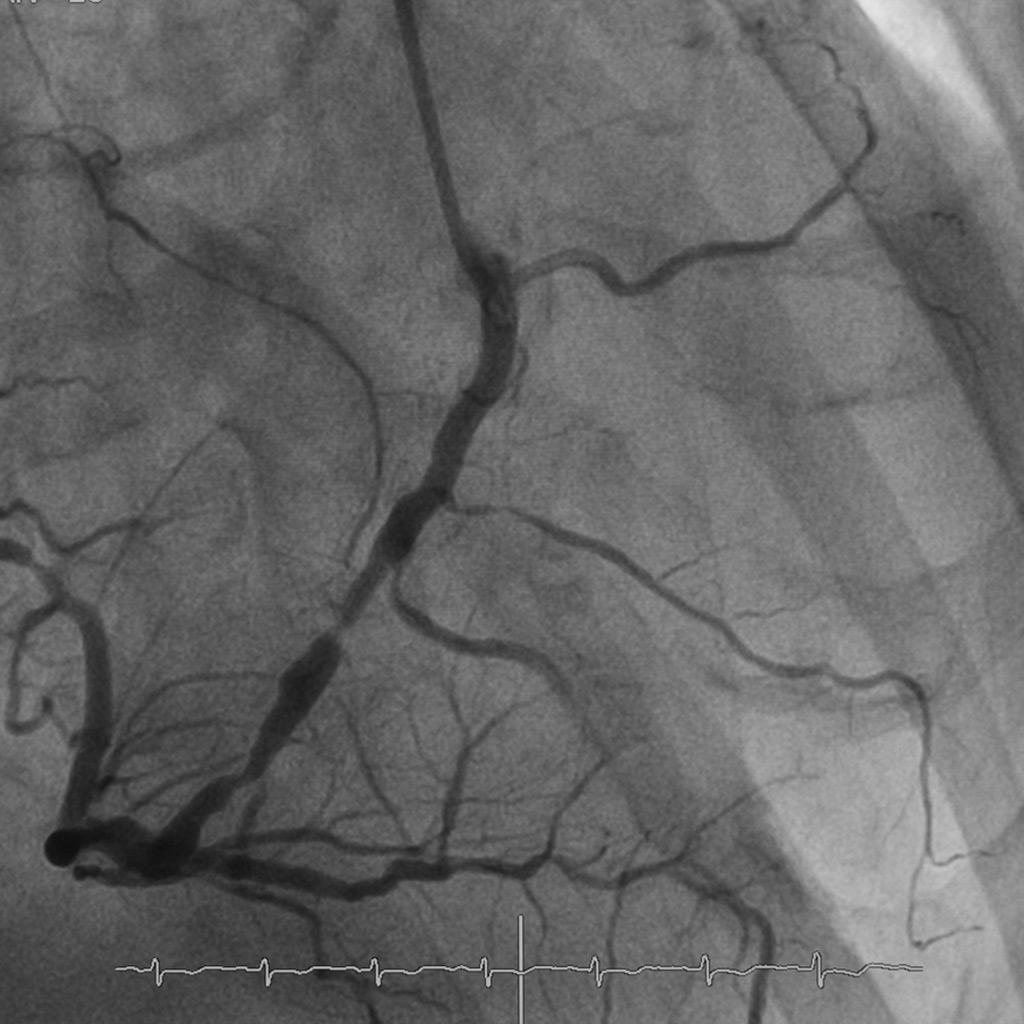 Best Heart Hospital in Ludhiana