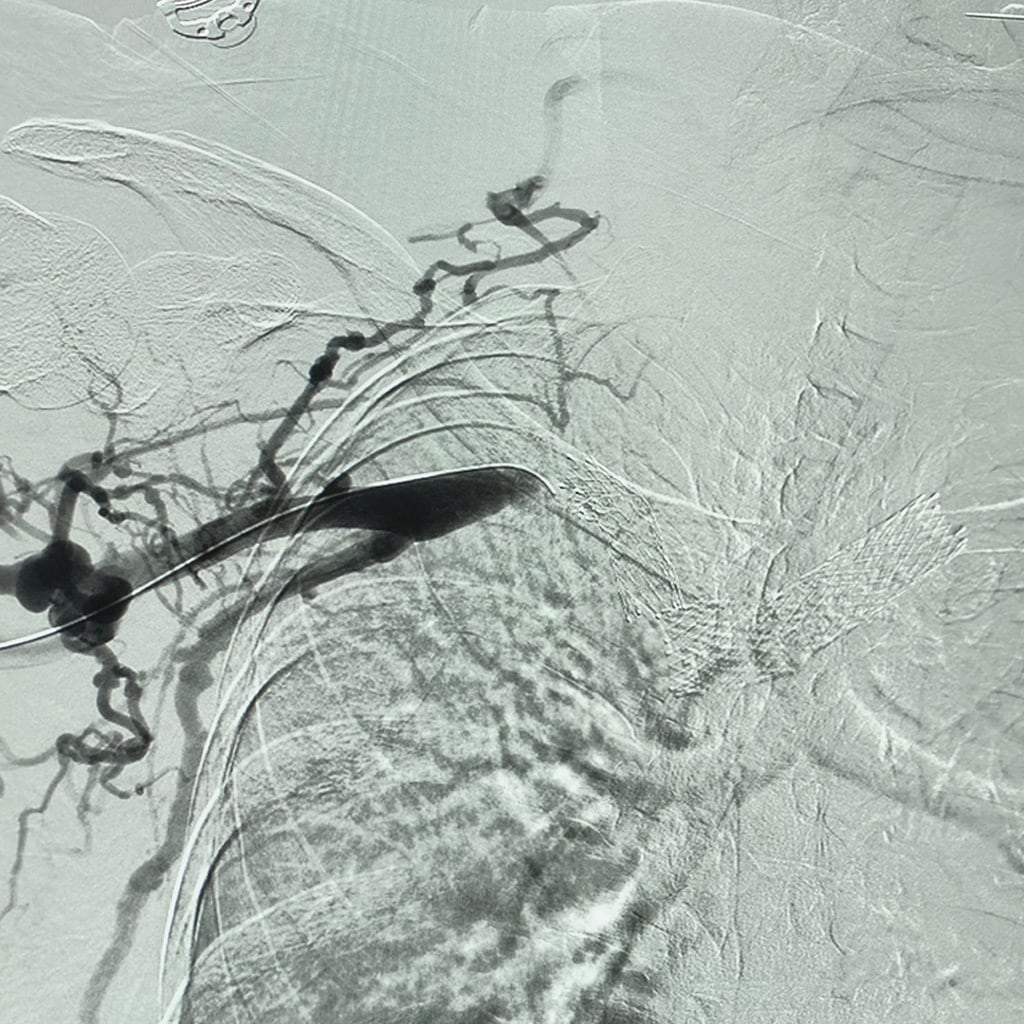 Best Heart Hospital in Ludhiana