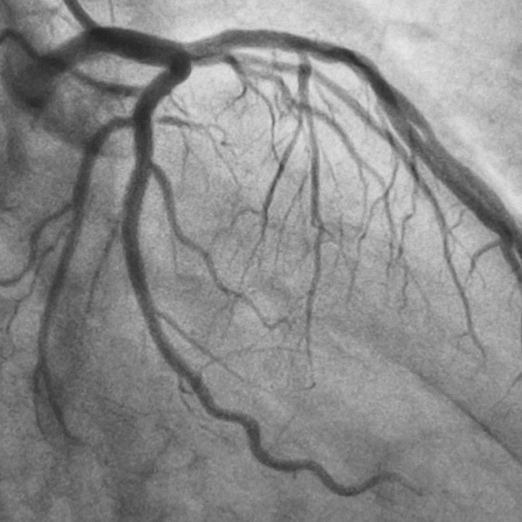 Best Heart Hospital in Ludhiana