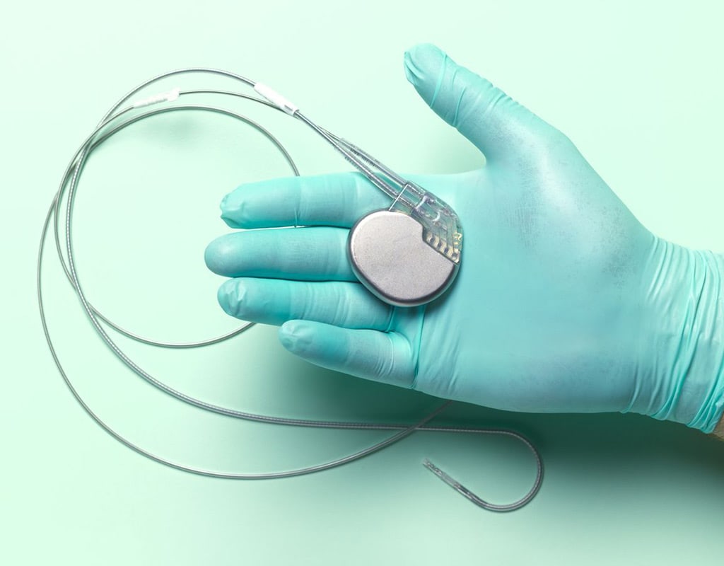 पेसमेकर कैसे आपके दिल की धड़कन को नियंत्रण में रखती है ?