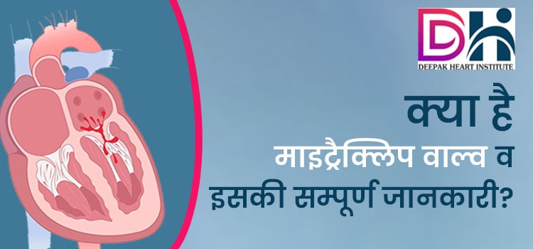 क्या है माइट्रैक्लिप वाल्व व इसकी सम्पूर्ण जानकारी ?