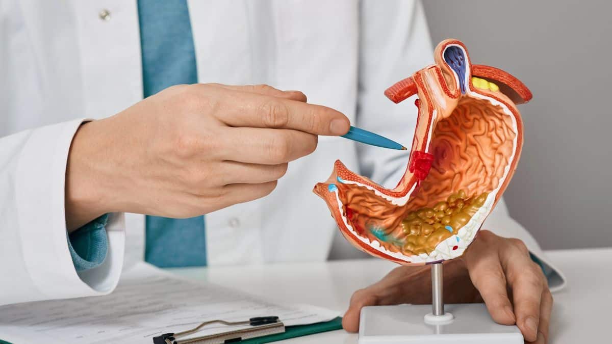 3. Detailed anatomical model of the human stomach used for medical education and gastrointestinal health diagnosis.