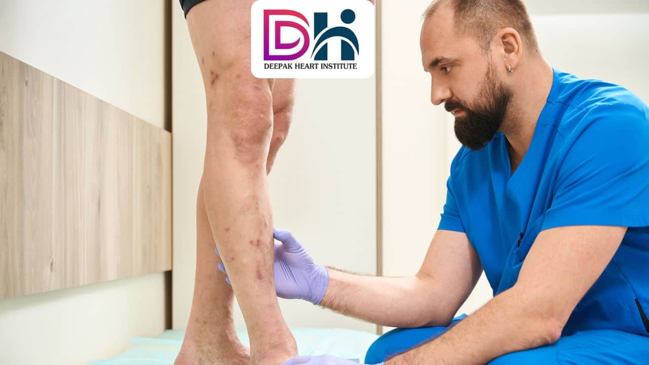 वैरिकोज़ वेन सर्जरी क्या है और इससे कौन सी समस्या हल होती है